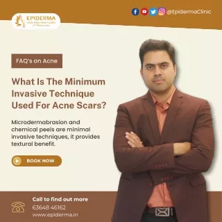 Treatments used for Acne Scars | Dermatologist in Jayanagar | Epiderma Clinic