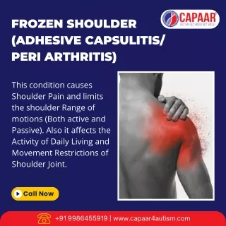 Frozen Shoulder | Best Physiotherapy in Hulimavu, Bangalore | CAPAAR