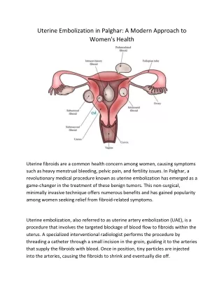 Uterine Embolization in Palghar