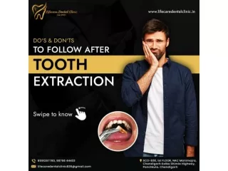 Wisdom Tooth Extraction | Orthodontic Treatment Chandigarh