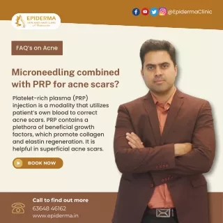 Microneedling combined with PRP for acne scars? | Epiderma Skin and Hair Clinic