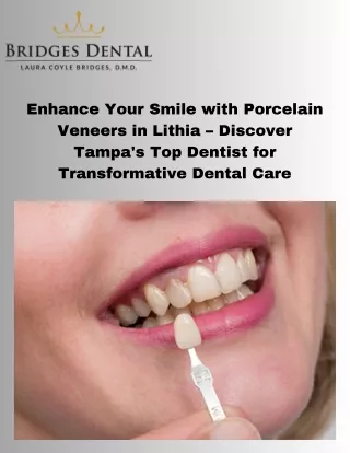 Enhance Your Smile with Porcelain Veneers in Lithia – Discover Tampa's Top Dentist for Transformative Dental Care