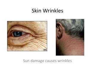 Skin Wrinkles