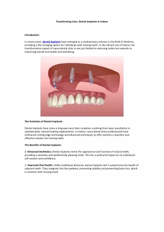 Transforming Lives Dental Implants in Indore