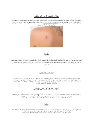 علاج الجدرة في الرياض