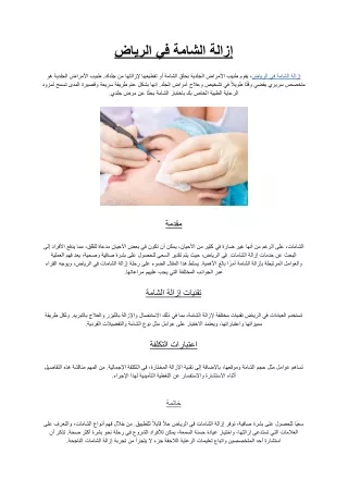 إزالة الشامة في الرياض