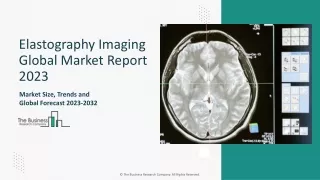 Elastography Imaging Market Share Analysis, Growth Trends 2023-2033