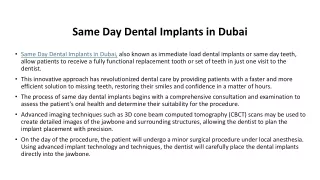 Same Day Dental Implants in Dubai