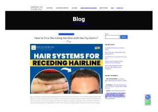 How to Fix a Receding Hairline with Hair Systems