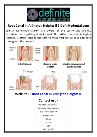 Root Canal In Arlington Heights  Definitedental.com