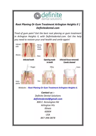 Root Planing Or Gum Treatment Arlington Heights Il  Definitedental.com