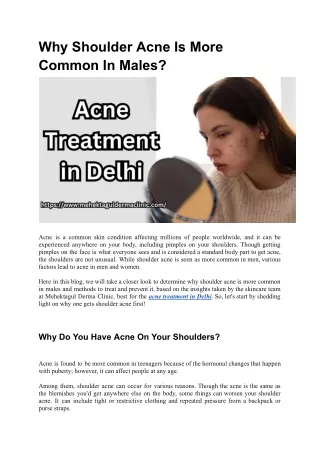 Acne Treatment in Delhi