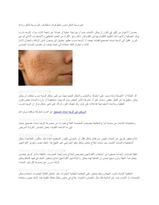 وداعًا للذقن المزدوجة