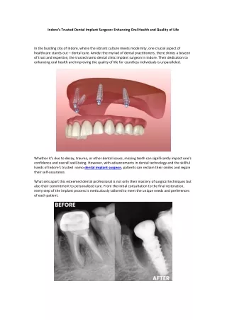 Indore's Trusted Dental Implant Surgeon Enhancing Oral Health and Quality of Life