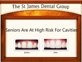 Elderly Are At High Risk For Dental Caries