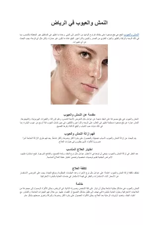 النمش والعيوب في الرياض