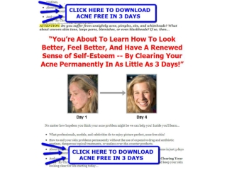 Acne Free In 3 Days Acne Free In 3 Days Book Download