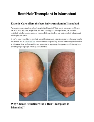 Esthetic Care offers the best hair transplant in Islamabad