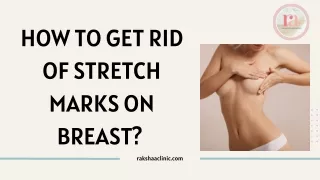 How To Get Rid Of Stretch Marks on Breast?