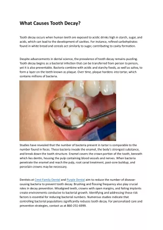 What Causes Tooth Decay?