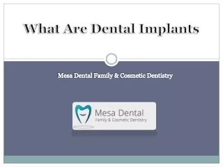 What Are Dental Implants