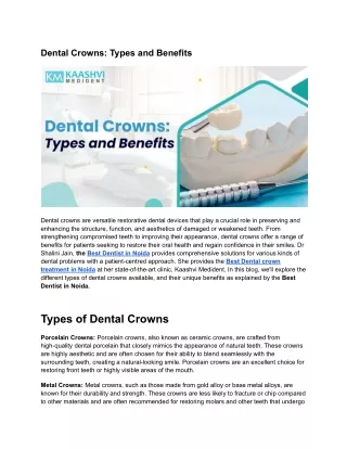 Dental Crowns_ Types and Benefits