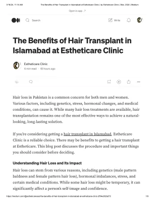 The Benefits of Hair Transplant in Islamabad at Estheticare Clinic _ by Estheticare Clinic _ Mar, 2024 _ Medium