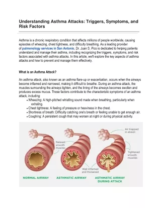 Understanding-Asthma-Attacks With Dr Juan S Pico