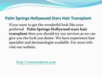 palm springs hollywood stars hair transplant