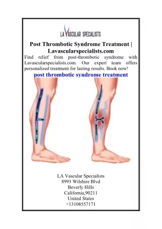 Post Thrombotic Syndrome Treatment  Lavascularspecialists.com