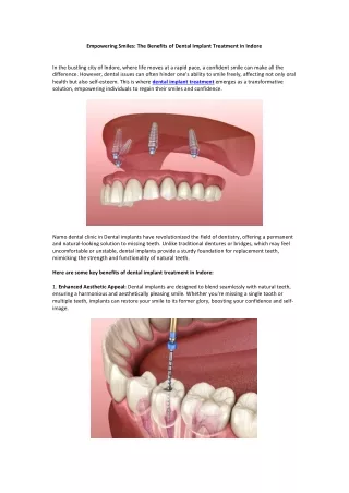 Empowering Smiles The Benefits of Dental Implant Treatment in Indore