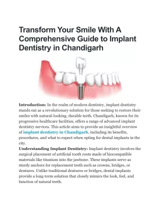 Implant Dentistry in Chandigarh By Dentafix