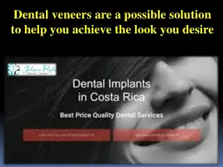 Dental veneers are a possible solution to help you achieve the look you desire