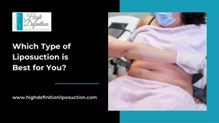 Which Type of Liposuction is Best for You - High Definition Liposuction