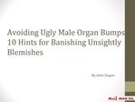 Avoiding Ugly Male Organ Bumps: 10 Hints