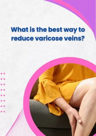 What are the best ways for varicose vein