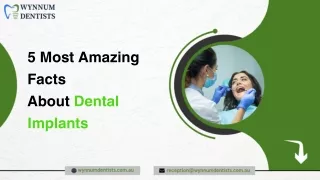 5 Most Amazing Facts About Dental Implants