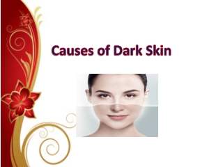 Causes of Skin Darkening