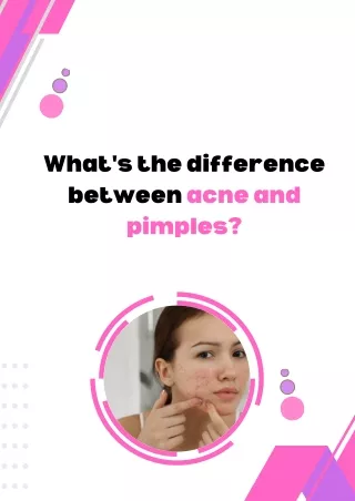 Unveiling the Difference Between Acne and Pimples