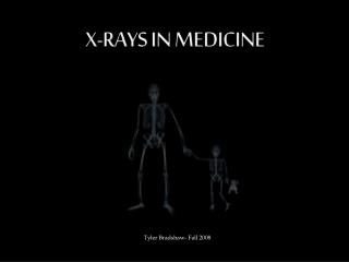 X-Rays in Medicine