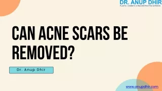 Can Acne Scars be Removed- Dr. Anup Dhir