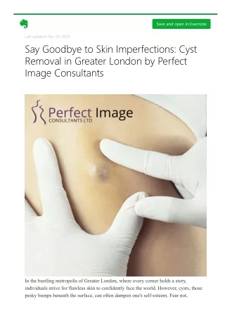 Say Goodbye to Skin Imperfections: Cyst Removal in Greater London by Perfect Ima