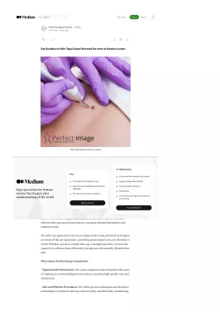 Say Goodbye to Skin Tags: Expert Removal Services in Greater London