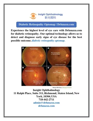 Diabetic Retinopathy Optomap  Drlunaxu.com