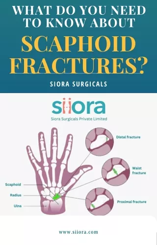 What Do You Need to Know About Scaphoid Fractures