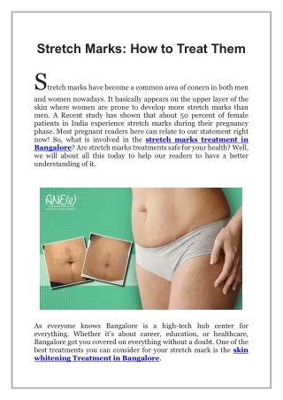 Stretch Marks, How to Treat Them