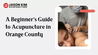 A Beginner's Guide to Acupuncture in Orange County