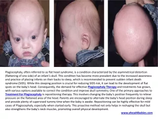 Flat Head Syndrome Treatment Positional Plagiocephaly Treatment