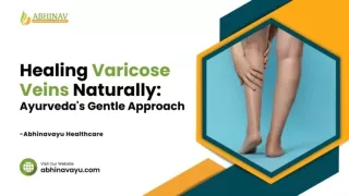 Healing Varicose Veins Naturally - Ayurveda's Gentle Approach