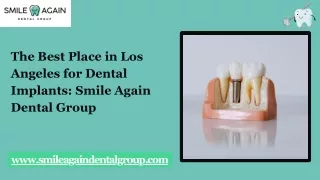 The Best Place in Los Angeles for Dental Implants Smile Again Dental Group